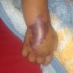 Bebê morre após contrair infecção no hospital de Barras