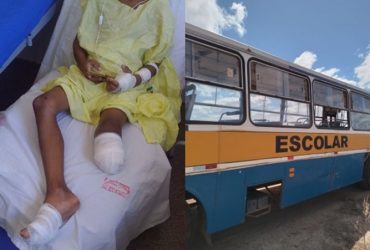 Criança tem perna amputada após cair de ônibus no interior do Piauí