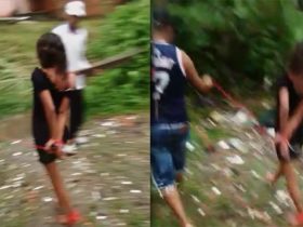 Jovem é brutalmente espancada por facção criminosa e ainda tem as duas pernas quebradas