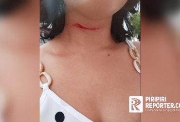 Mulher tem corte no pescoço ao ser atingida por linha de cerol no interior do Piauí