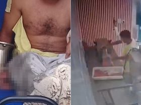 Homem tem mão triturada por moedor de carne em Teresina