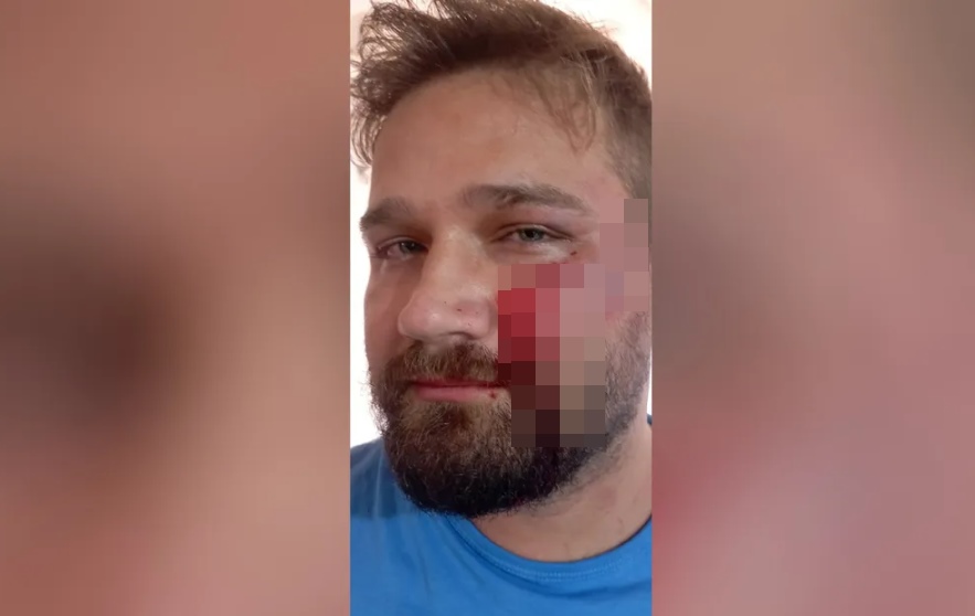 Médico diz que foi agredido após negar atestado de 3 dias