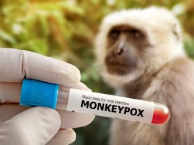Vacina contra a varíola dos macacos deve chegar ao Brasil este mês