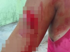 Briga entre mulheres deixa pessoa gravemente ferida a golpes de faca e madeirada no interior do Piauí