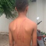 Jovem acusado de furto é chicoteado por populares no interior do Piauí