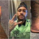 Neymar compartilha foto de tornozeiro inchado após lesão