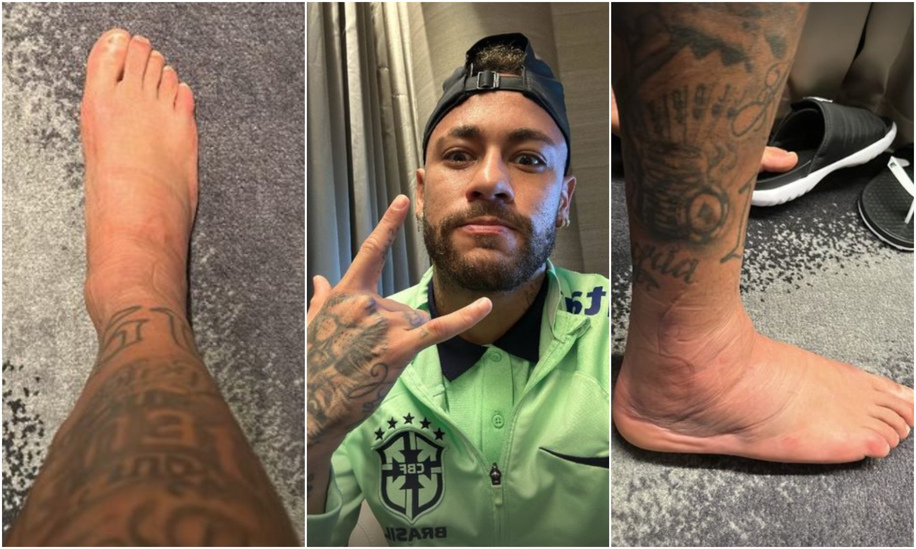 Neymar compartilha foto de tornozeiro inchado após lesão