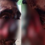 Homem leva tiros na cabeça durante assalto em Jatobá do Piauí e sobrevive