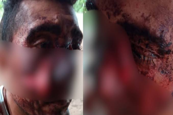 Homem leva tiros na cabeça durante assalto em Jatobá do Piauí e sobrevive