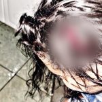 Homem tenta estuprar vizinha e taca pedra na cabeça dela em Teresina