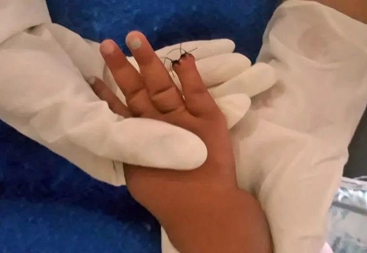 Enfermeira amputa acidentalmente dedo de bebê