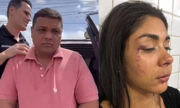Gordinho do Peixe acusado de agredir blogueira é liberado pela justiça em Teresina