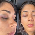 Mulher desmaia após ser agredida por ex-namorado de amiga em Teresina