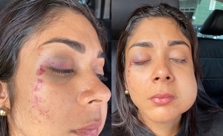 Mulher desmaia após ser agredida por ex-namorado de amiga em Teresina