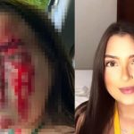 Crise de ciúmes: Jovem estudante é agredida pelo namorado em Teresina