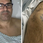 Homem viraliza após escrever "sim" e "não" nos joelhos antes de procedimento cirúrgico