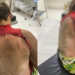 Homem é preso suspeito de atear fogo na companheira enquanto ela dormia no Piauí