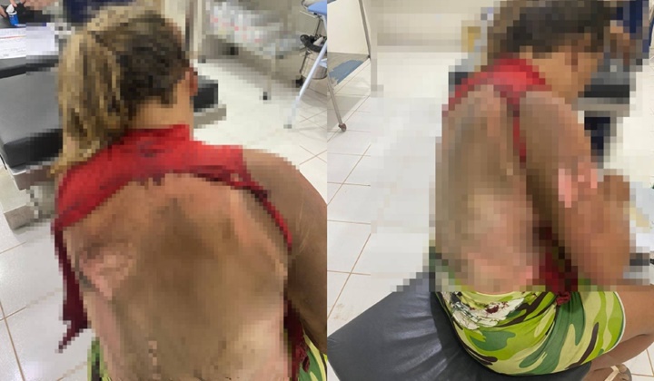 Homem é preso suspeito de atear fogo na companheira enquanto ela dormia no Piauí
