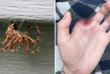 Homem amputa dedo após picada de aranha-marrom