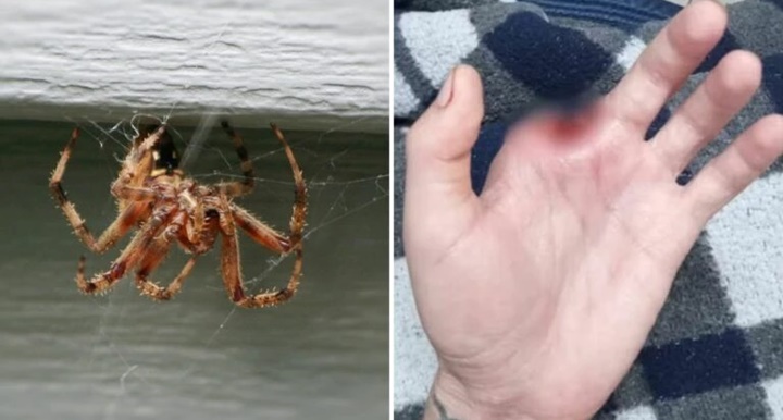 Homem amputa dedo após picada de aranha-marrom
