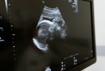 Lei: Gestantes terão que ouvir os batimentos do bebê antes de abortar em Goiás