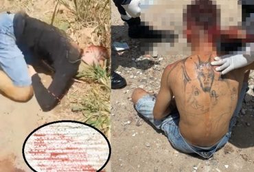 Faccionado com tatuagem de satanás nas costas, sobrevive após ser baleado na nuca e cabeça