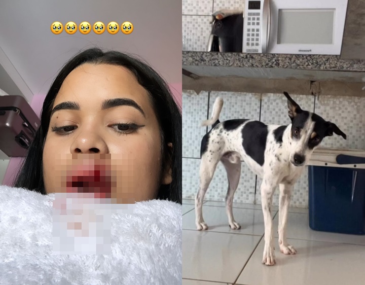 Jovem pega pontos nos lábios após tentar beijar cachorro de estimação no Piauí 