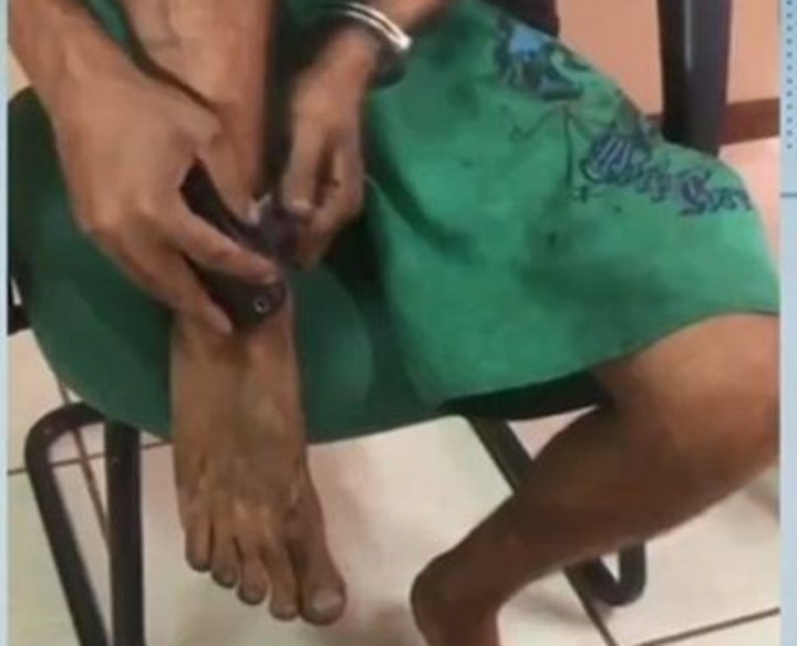 Suspeito de roubos, retirava tornozeleira eletrônica para praticar crimes