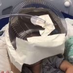 Hospital usa embalagem de bolo como máscara de oxigênio em bebê de 3 meses