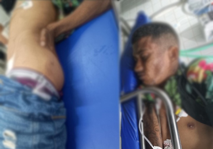 Suspeito leva tiro nas nádegas após tentar assaltar casa no Piauí