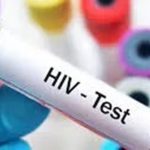 Nova variante do HIV circula em 3 estados do Brasil, aponta estudo