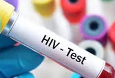 Nova variante do HIV circula em 3 estados do Brasil, aponta estudo