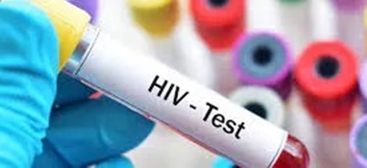 Nova variante do HIV circula em 3 estados do Brasil, aponta estudo