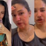 Blogueira é agredida com golpes de tesoura por grupo de mulheres em Pio IX