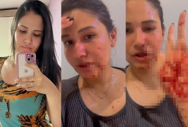 Blogueira é agredida com golpes de tesoura por grupo de mulheres em Pio IX