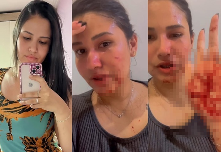 Blogueira é agredida com golpes de tesoura por grupo de mulheres em Pio IX